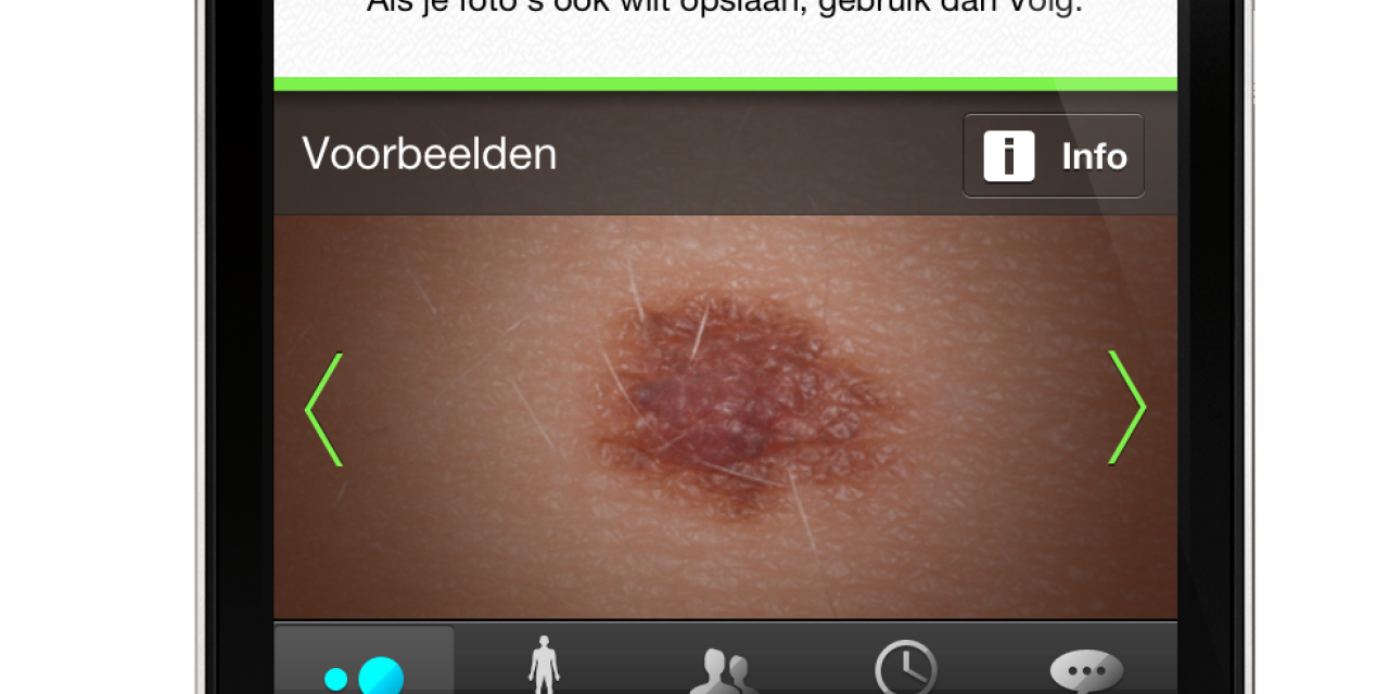 Slimme app om signalen van huidkanker te herkennen